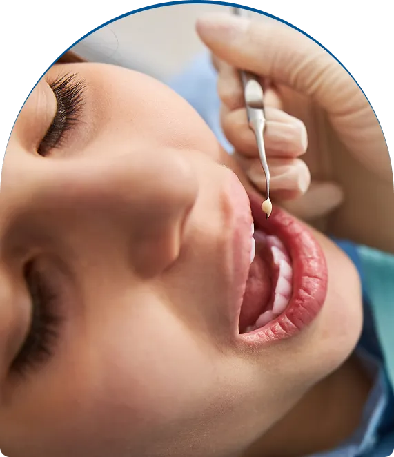 Inlays & Onlays near you