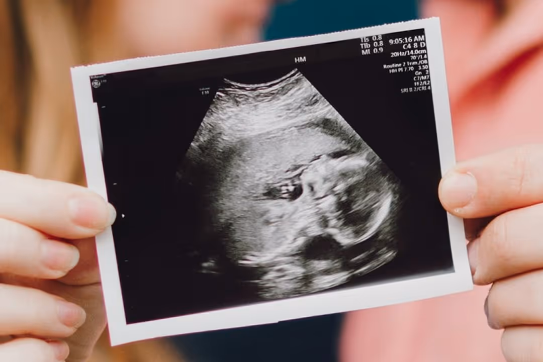 Image of a couple holding an ultrasound scan