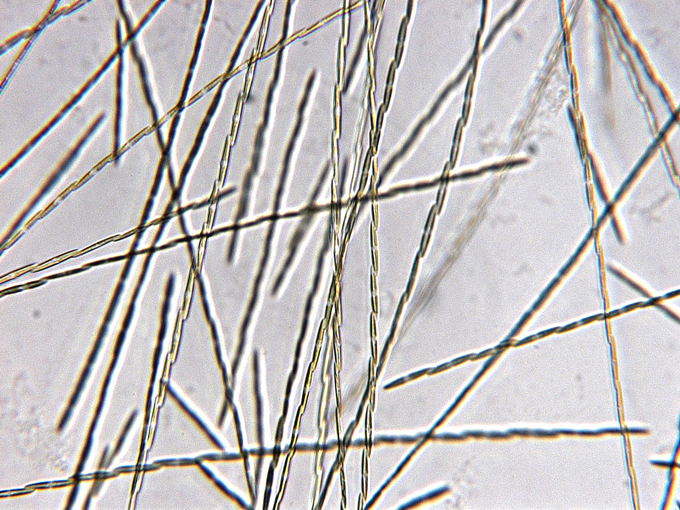 Chains of Pseudo-nitzschia sp., a diatom that can produce domoic acid