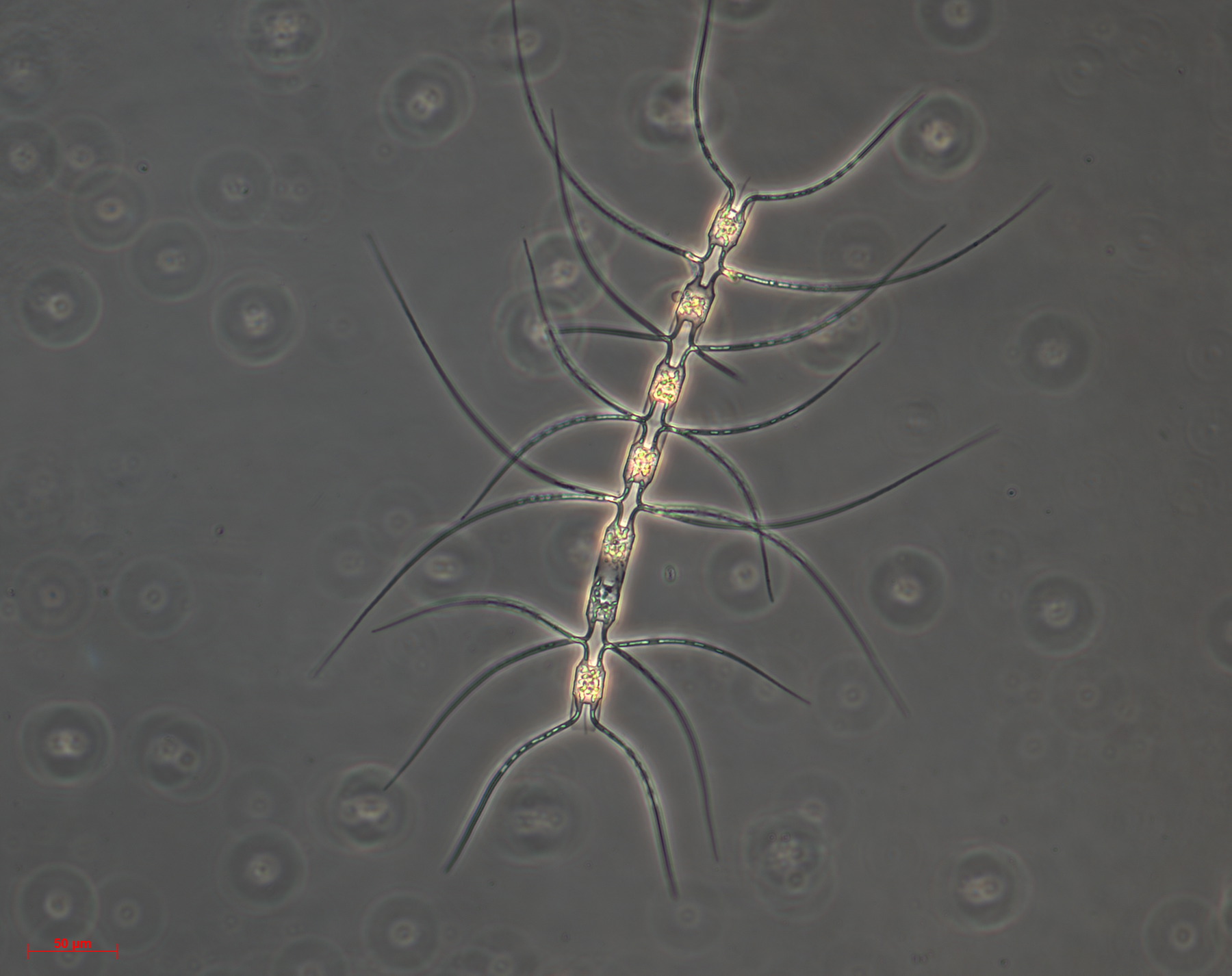 Chaetoceros dichaeta diatom from an iron-enhanced bloom (EIFEX), photographed by the Alfred Wegener Institute.