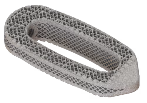 Osseus -interbody-fusion-device