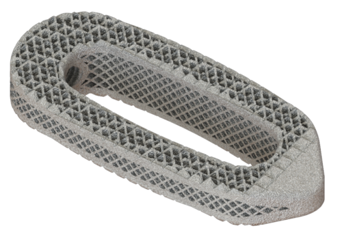 Osseus -interbody-fusion-device