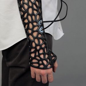3D printed prosthetics