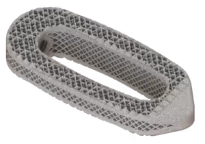 Osseus -interbody-fusion-device