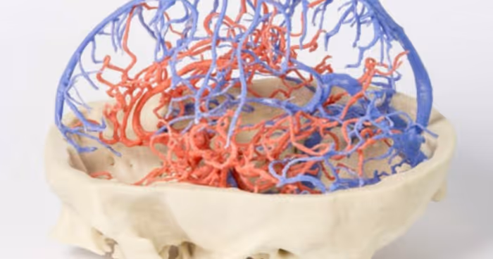 3D-printed brain model