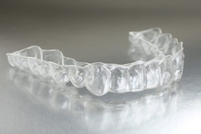 aligners