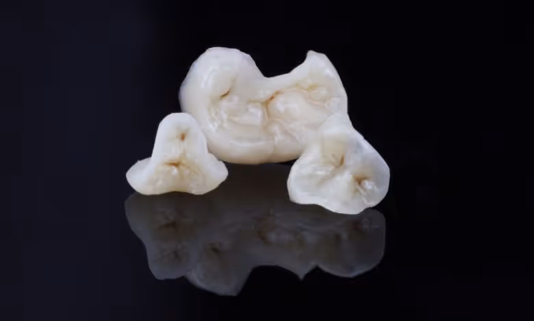 VOXELTEK printed restorations 2 copia 780x470.jpg
