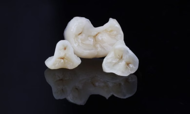 VOXELTEK printed restorations 2 copia 780x470.jpg