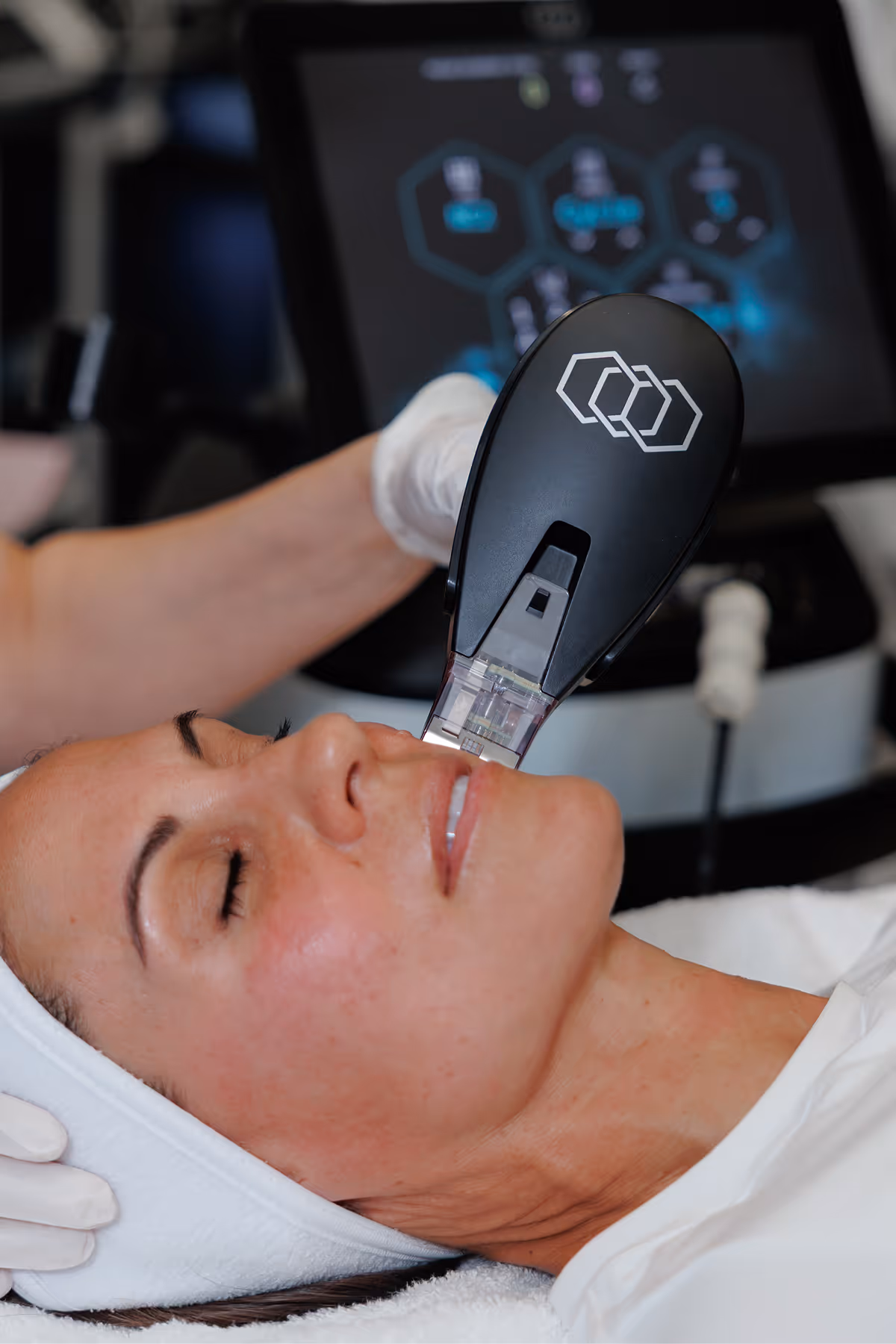 Patient receiving an EMFACE facial contouring treatment at a medspa to lift facial features, improve skin tone, and reduce the appearance of wrinkles.