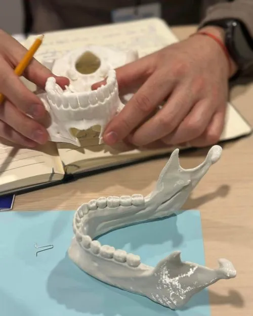 Ортодонтски модели на син фон, ръце и маркер