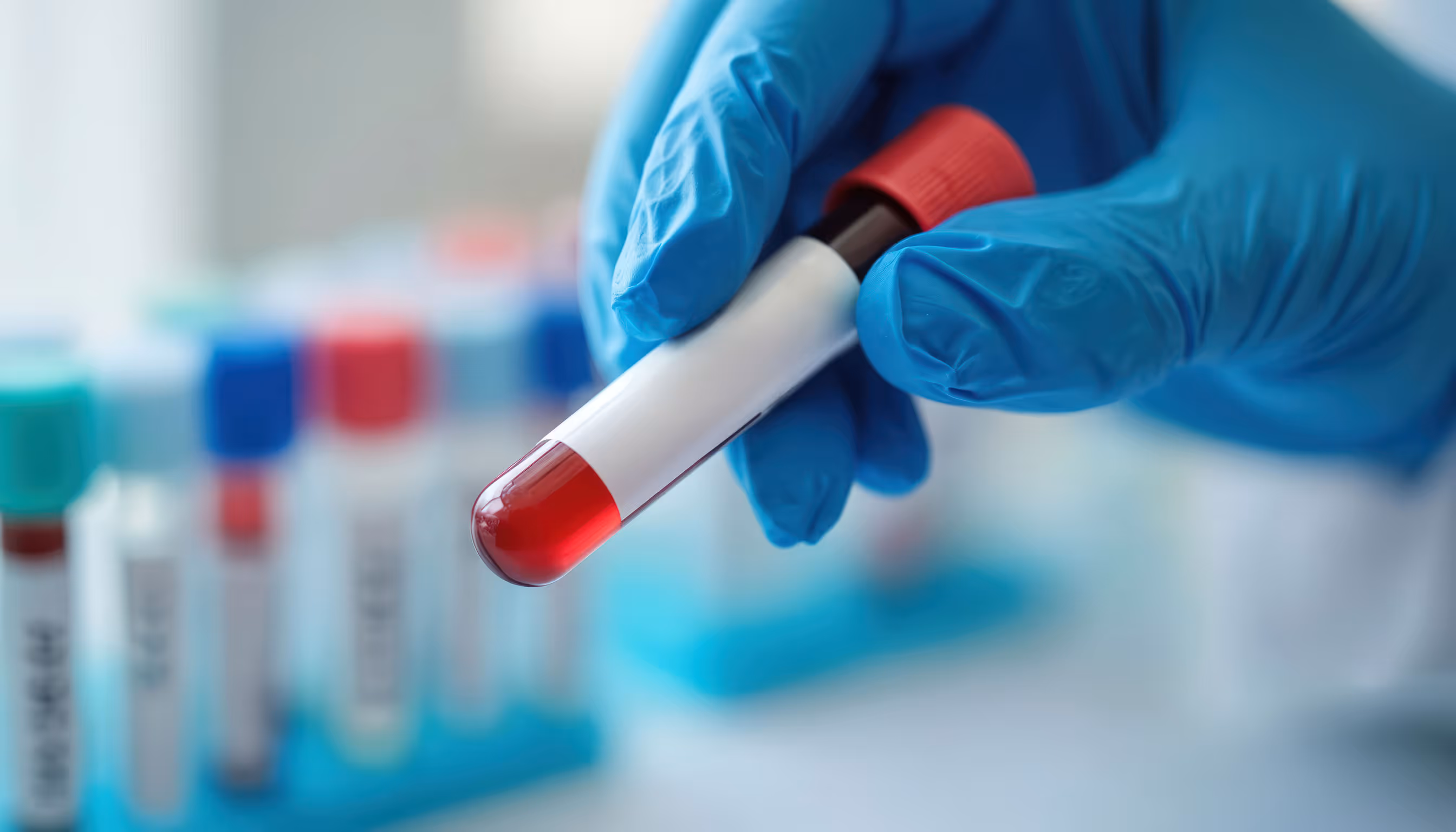 MD diagnostics full service lab