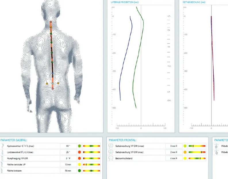 Ergebnis DIERS postura Scan