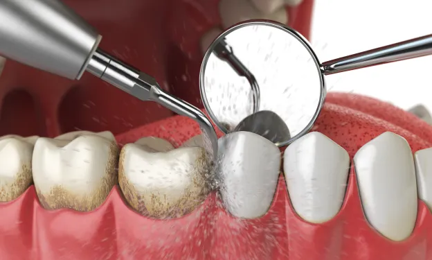 A close up of a tooth with a magnifying glass.