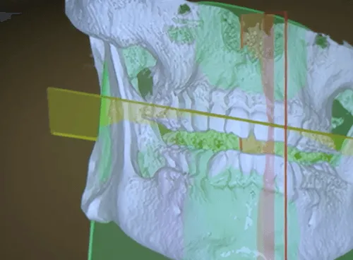 A picture of a dental model of the mouth.