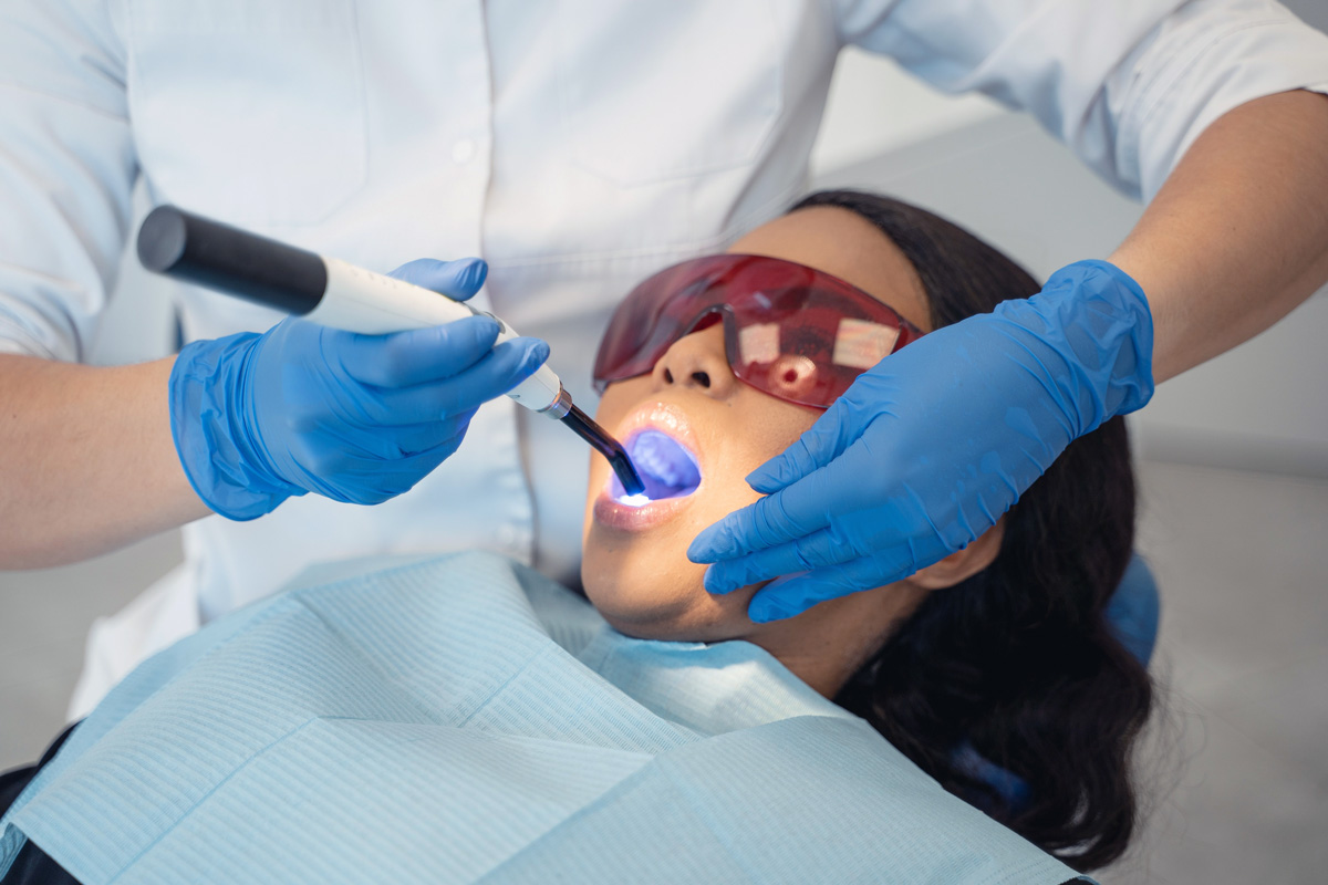 Dental bonding procedure.