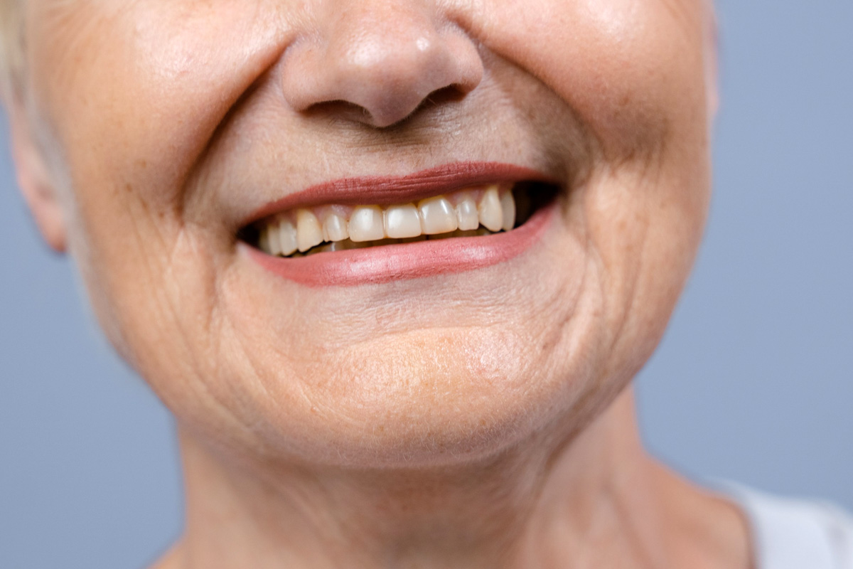 Woman with burning mouth syndrome smiling.