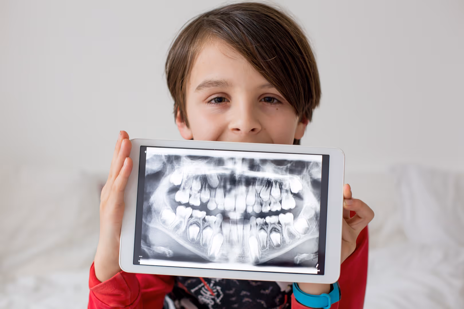 Digital X-rays