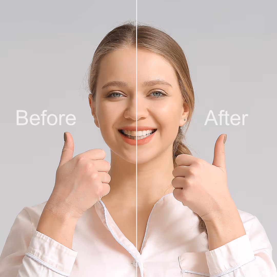 Smile Makeovers