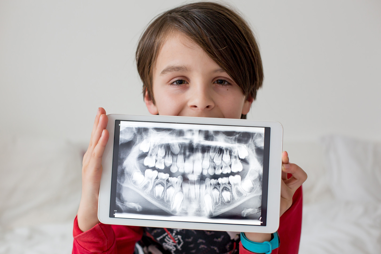 Digital X-rays