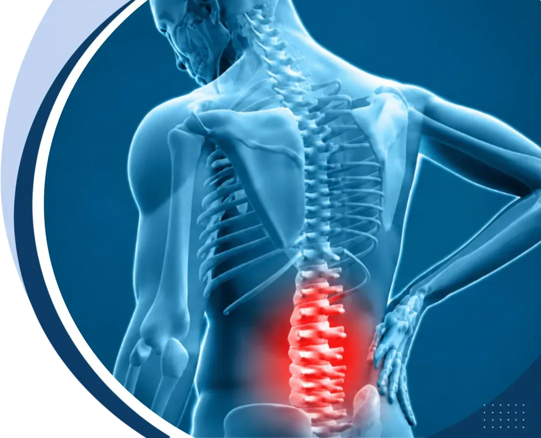 3D medical illustration of the spine with lower-back pain highlighted