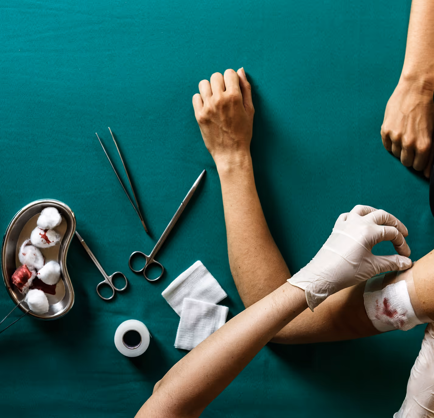 An image of a patient getting medical bandages placed around his arm.