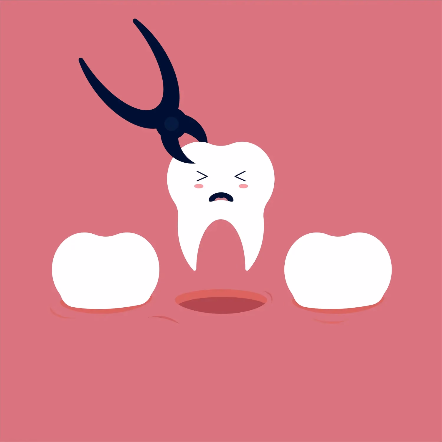 Tooth extraction image