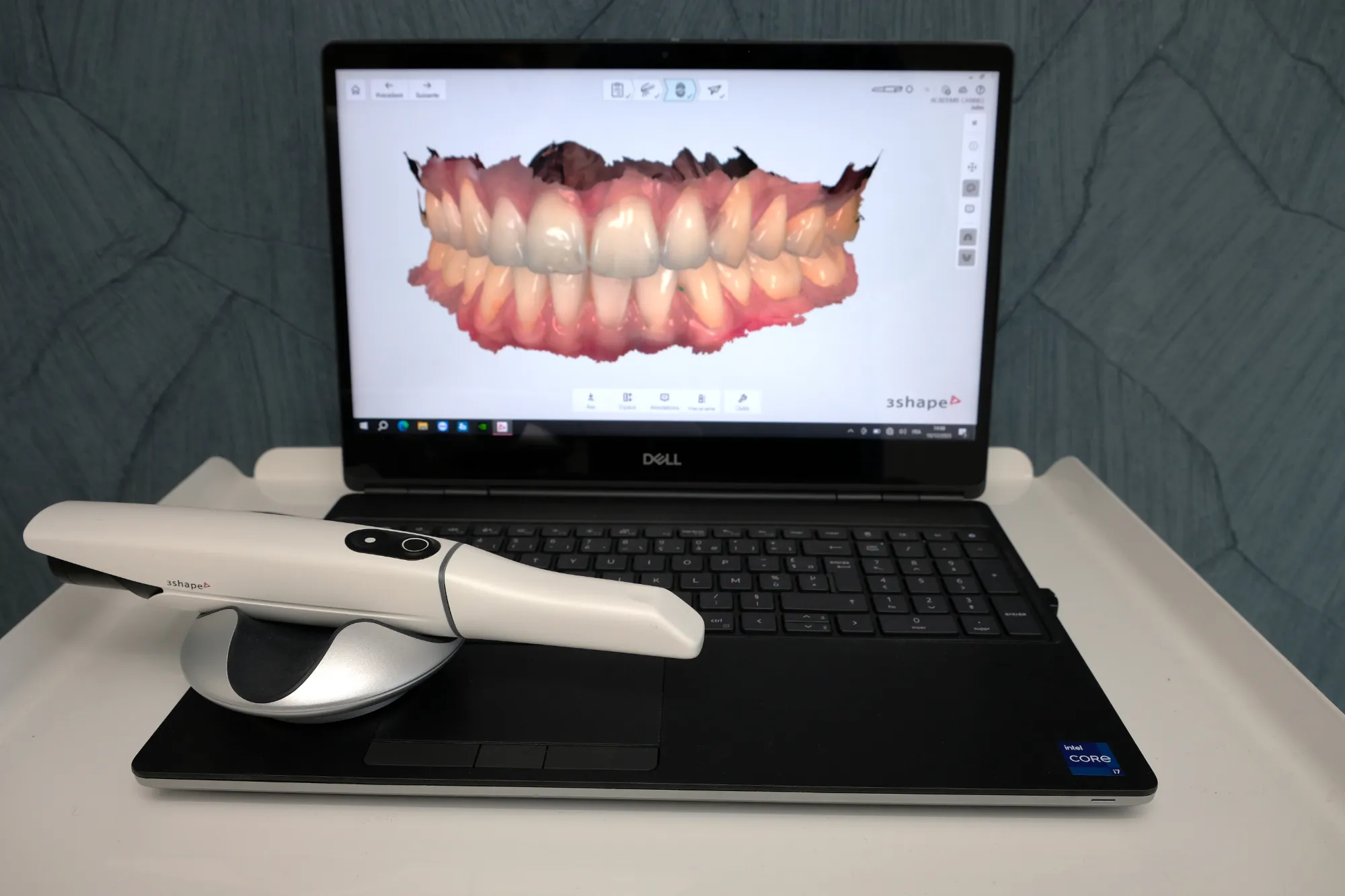 Scanner 3Shape utilisé au Labo 57 à Cannes pour la numérisation dentaire de haute précision