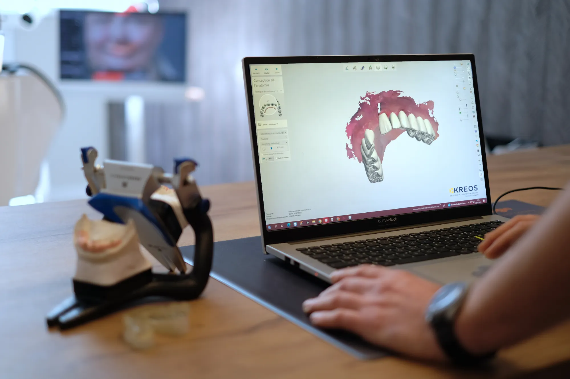 Numérisation dentaire numérique réalisée au Labo 57 à Cannes avec scanner de haute précision