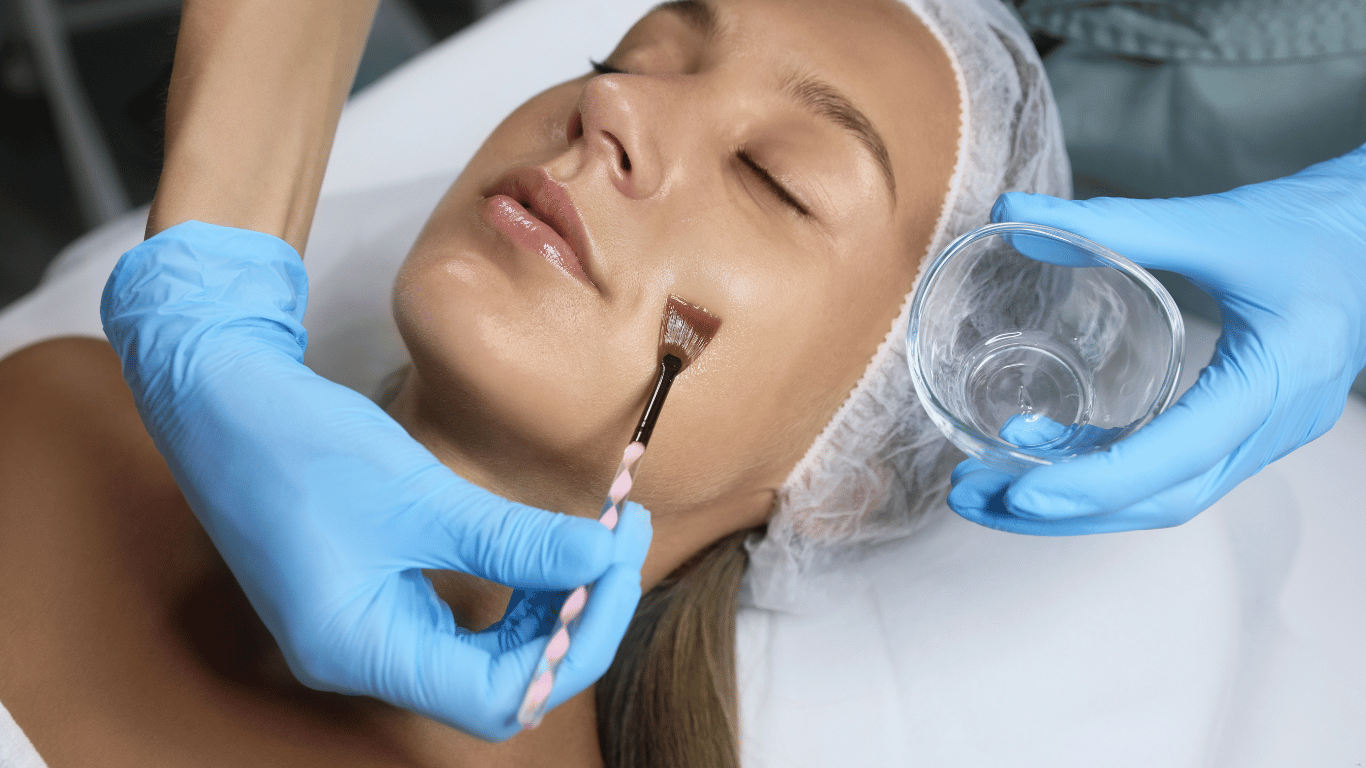 chemical peels