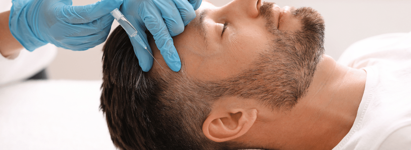 prp injection site for hair restoration