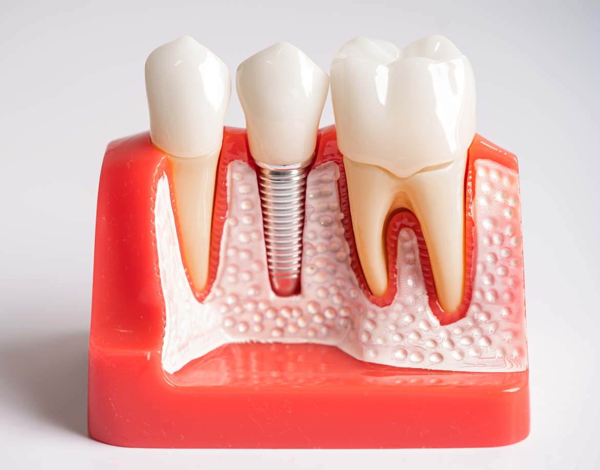 Modern dental equipment used during implant consultations