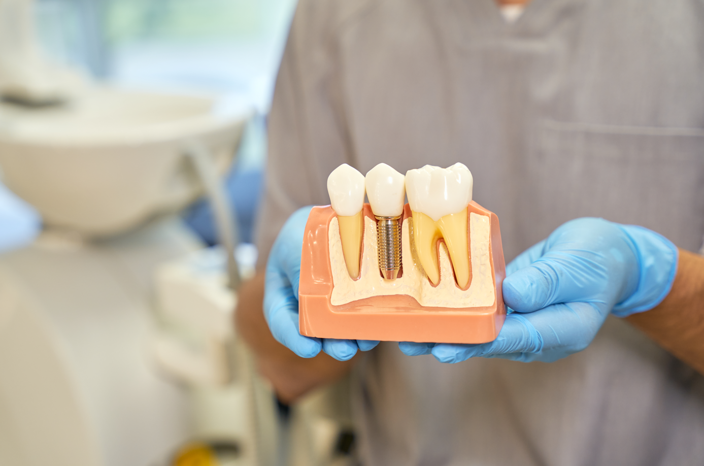 Dental implant model showing implant post and crown
