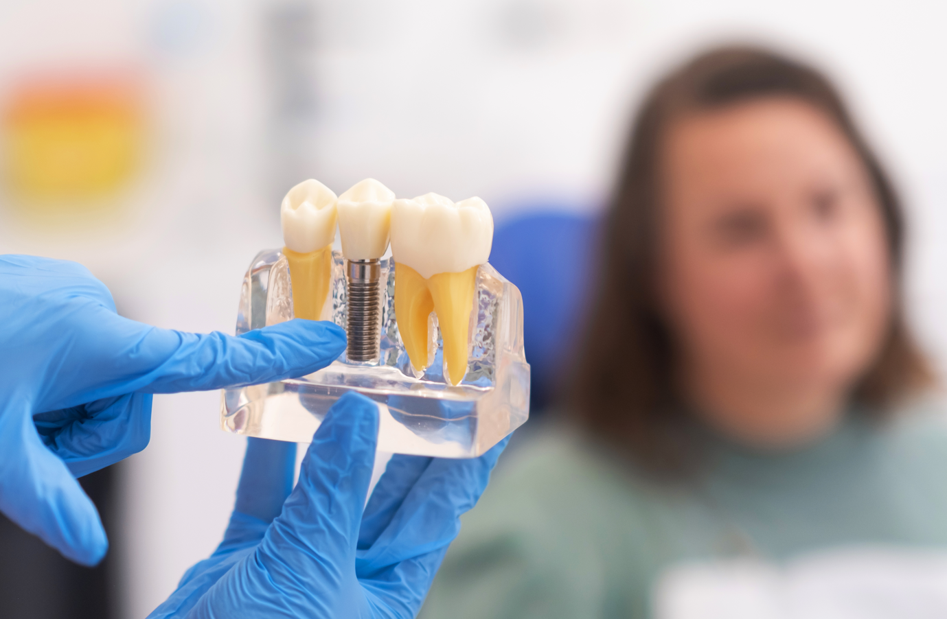 A person wearing blue gloves holds a dental model demonstrating a dental implant system in front of a blurred patient. — Clio