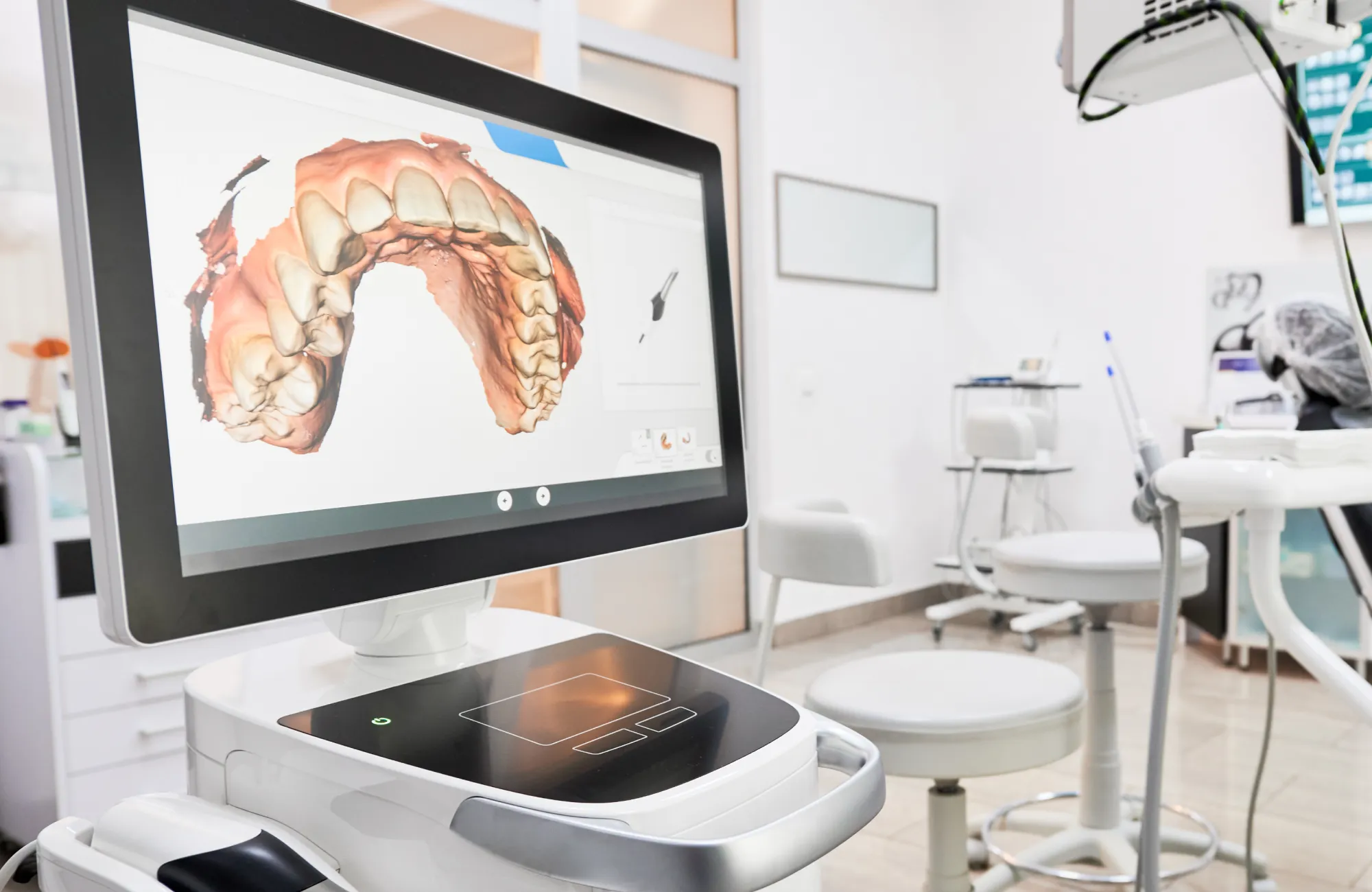 A digital dental scanner displays a 3D image of teeth on a screen in a clinic.