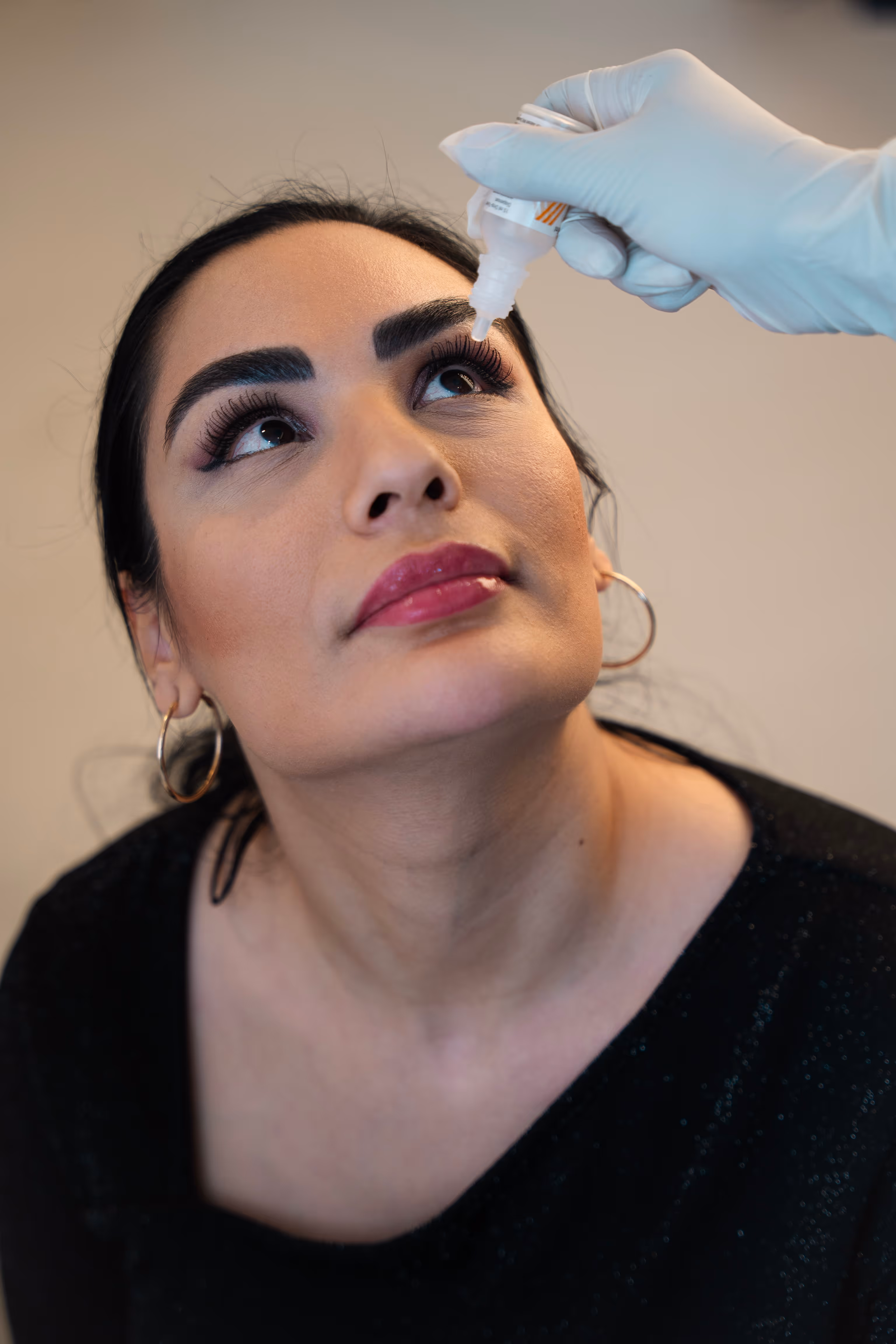 Close-up of a woman receiving eye drops from a gloved hand above her right eye.