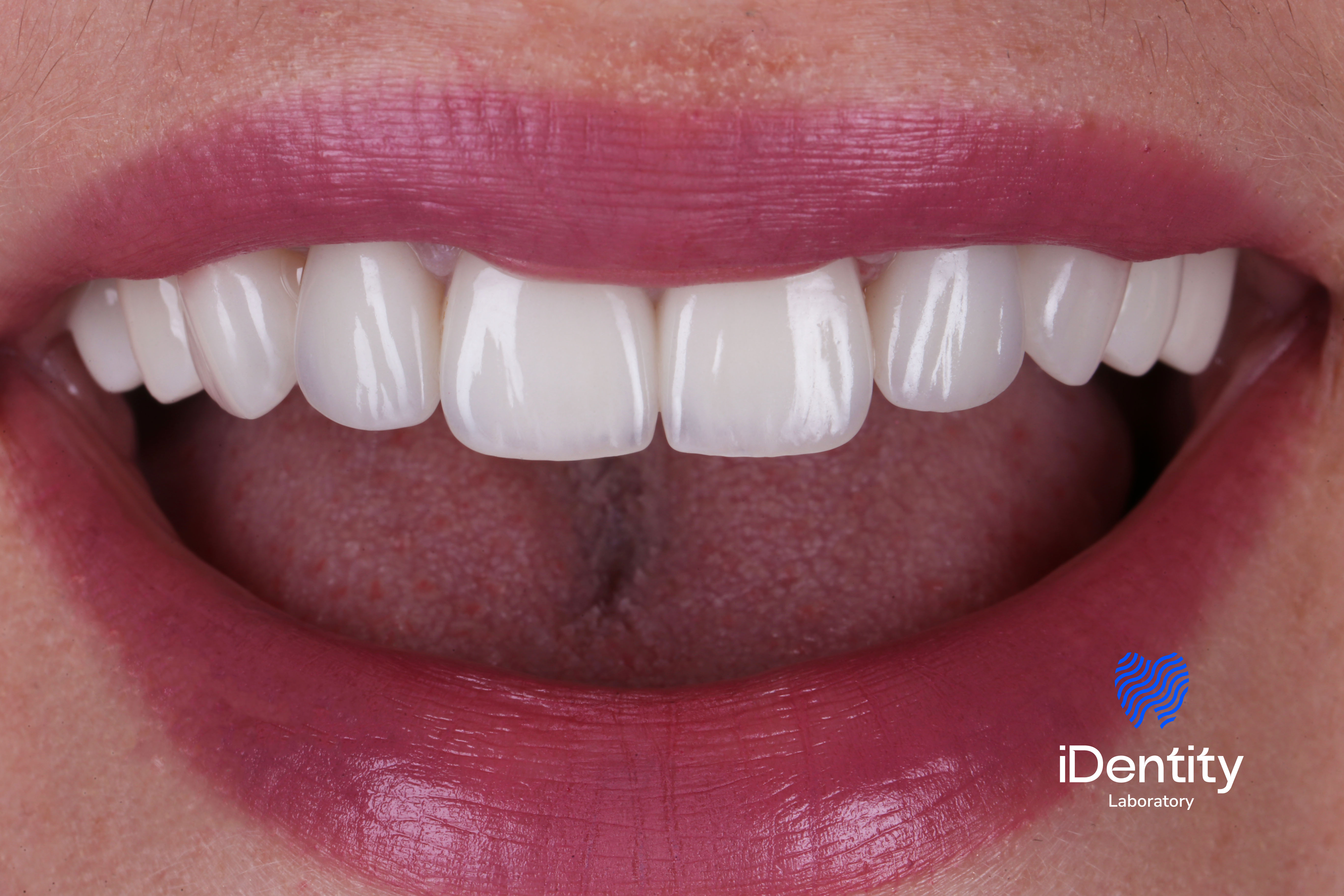 Close-up of a smiling mouth with white teeth and pink lipstick.