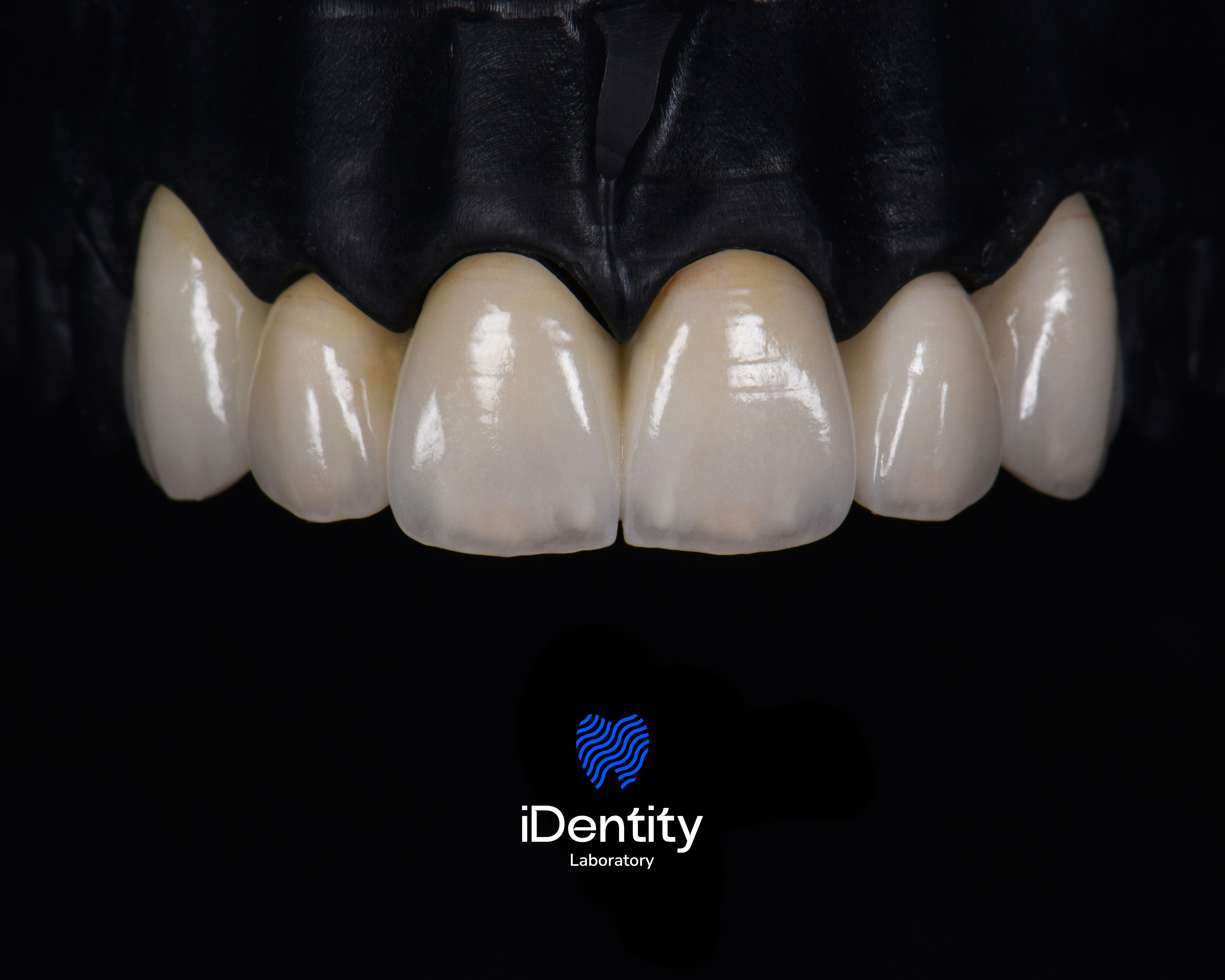 Close-up of six polished upper front teeth on a black background with iDentity Laboratory logo below.