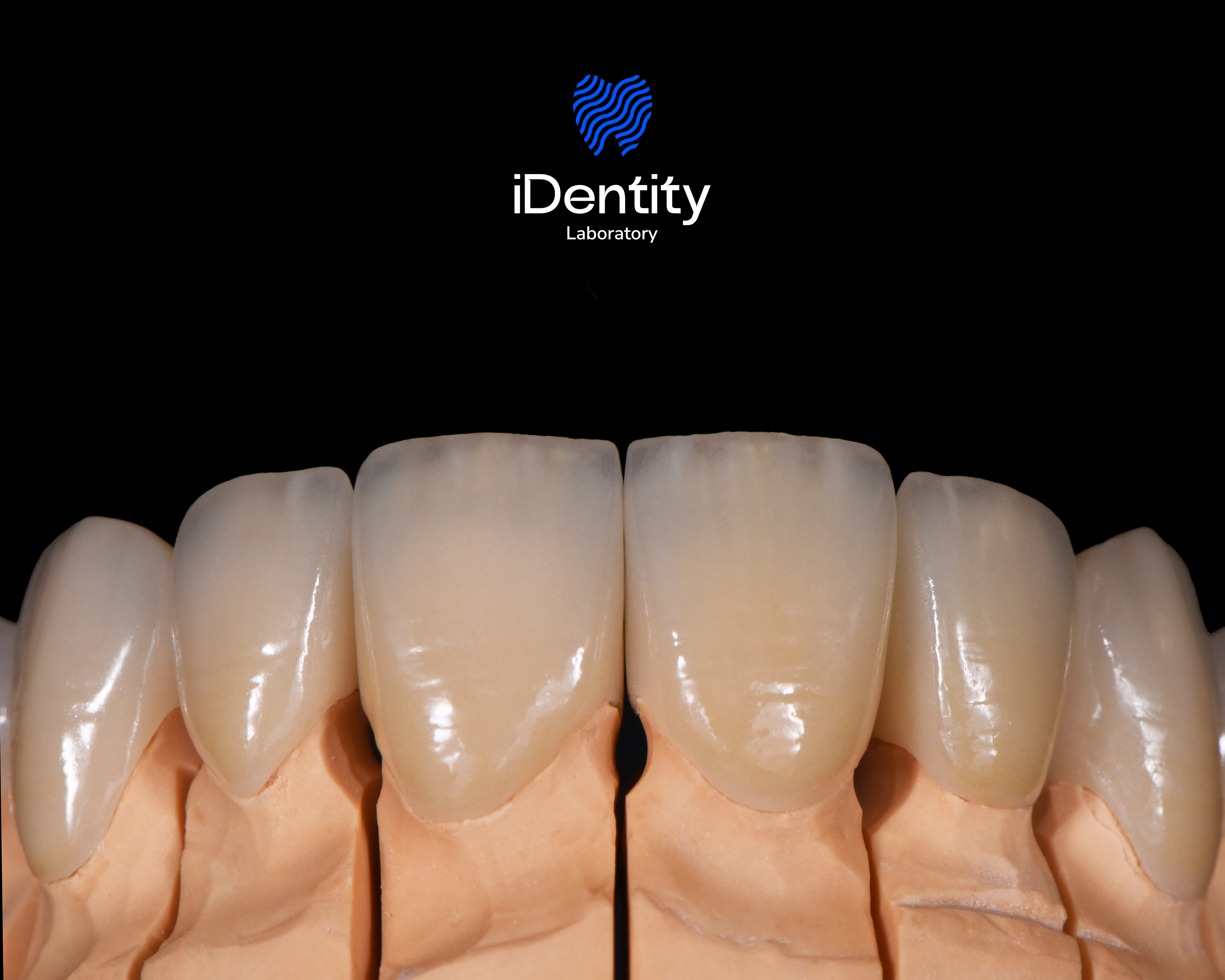 Close-up of six realistic dental prosthetic teeth on a beige mold with a black background and iDentity Laboratory logo above.