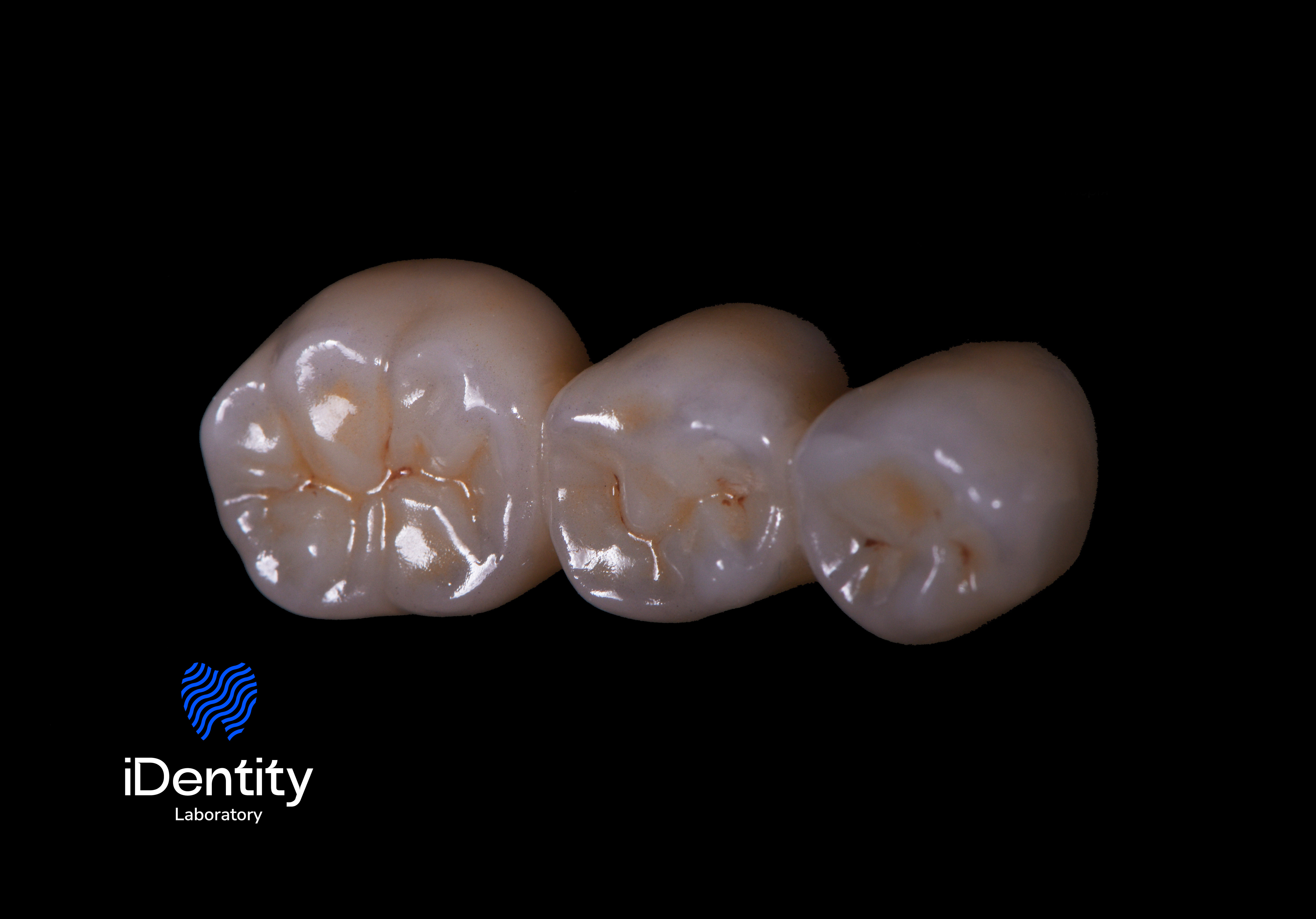 Close-up of three artificial dental crowns aligned in a row on a black background.