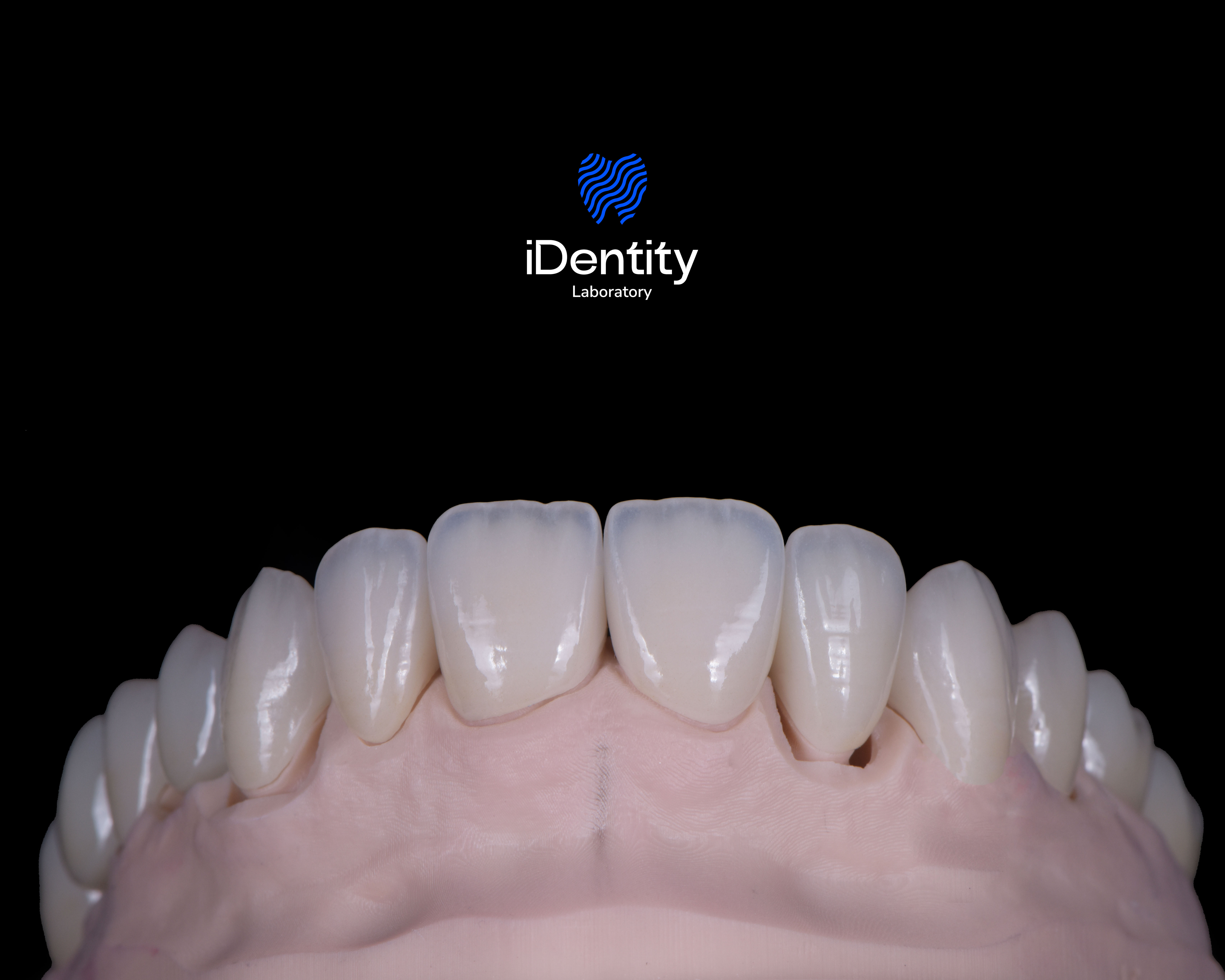 Close-up of dental model showing upper front teeth with natural-looking white crowns against a black background and identity laboratory logo above.
