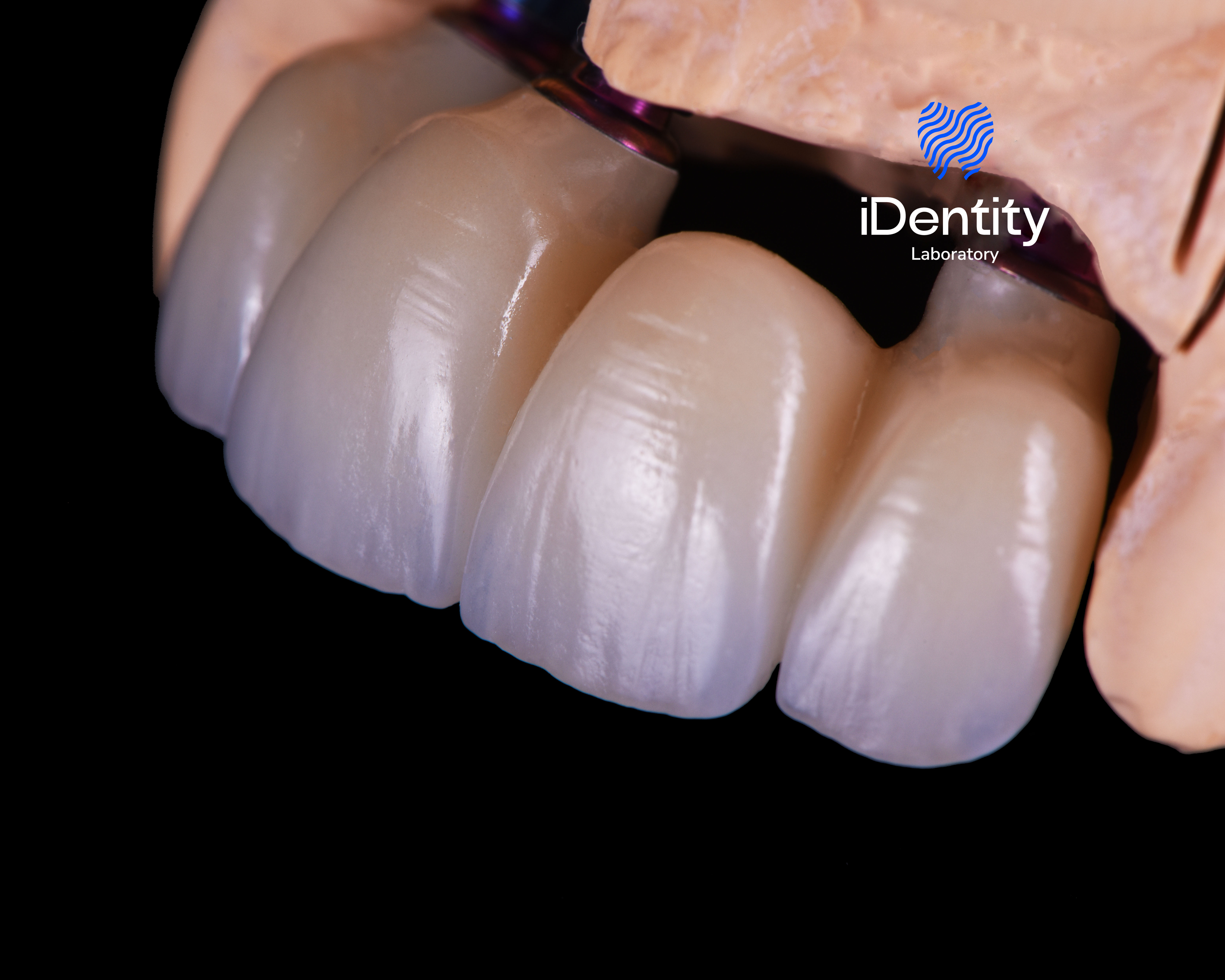 Close-up of dental prosthetic teeth with a pink gum base on a black background.