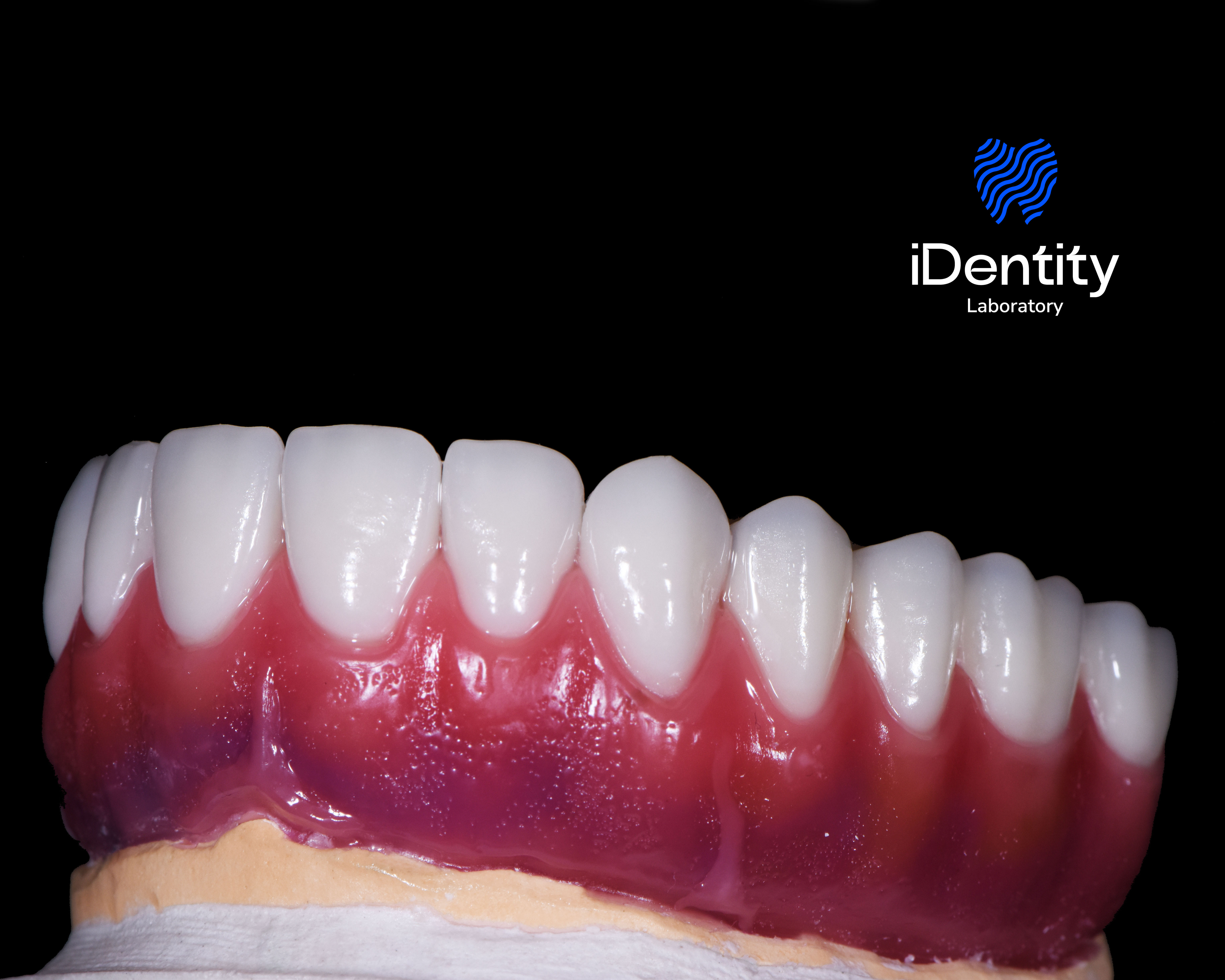 Close-up of a dental prosthetic model with white teeth and red gums on a black background.