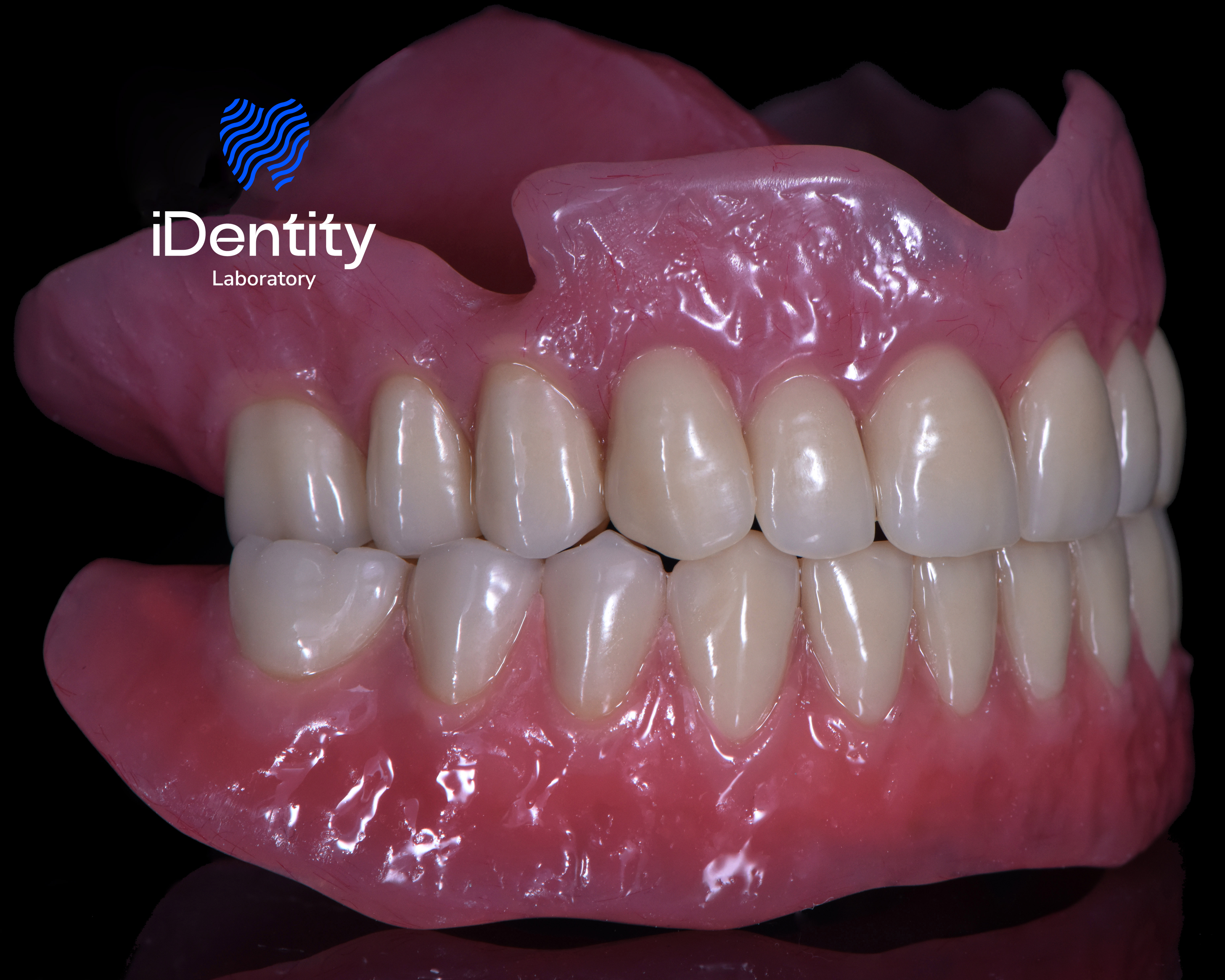 Close-up of full upper and lower dentures with realistic teeth and pink gums on a black background.