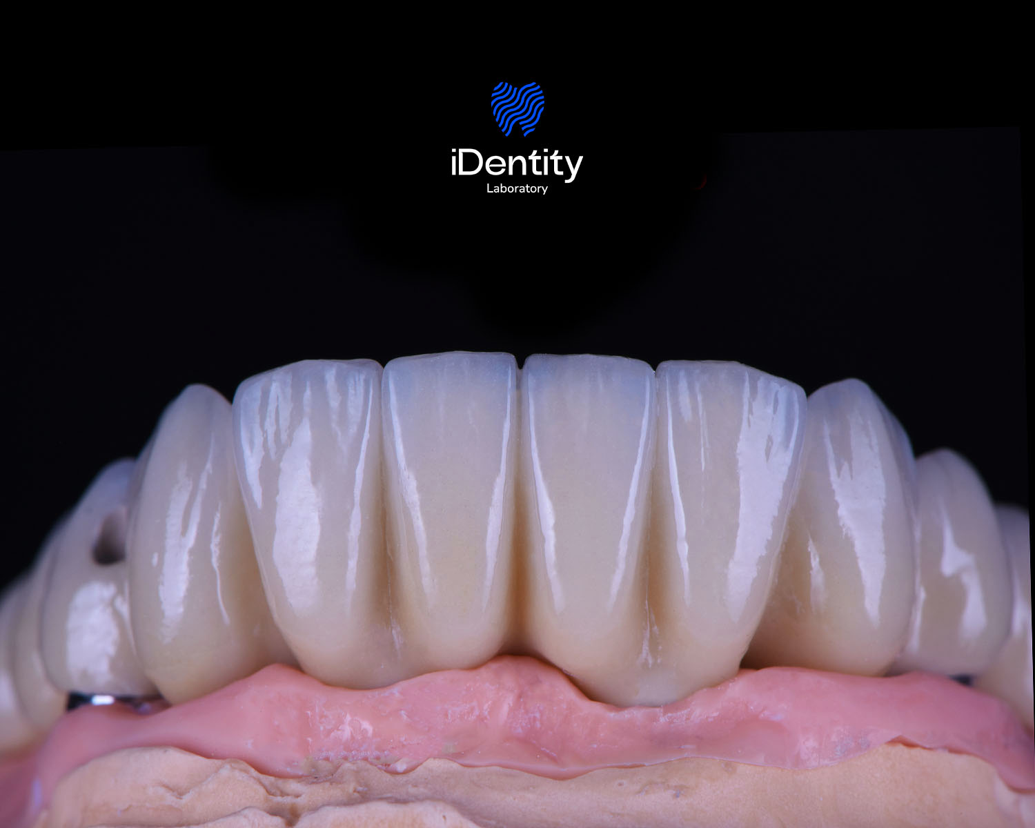 Close-up of dental prosthetic teeth mounted on a pink gum model against a black background.