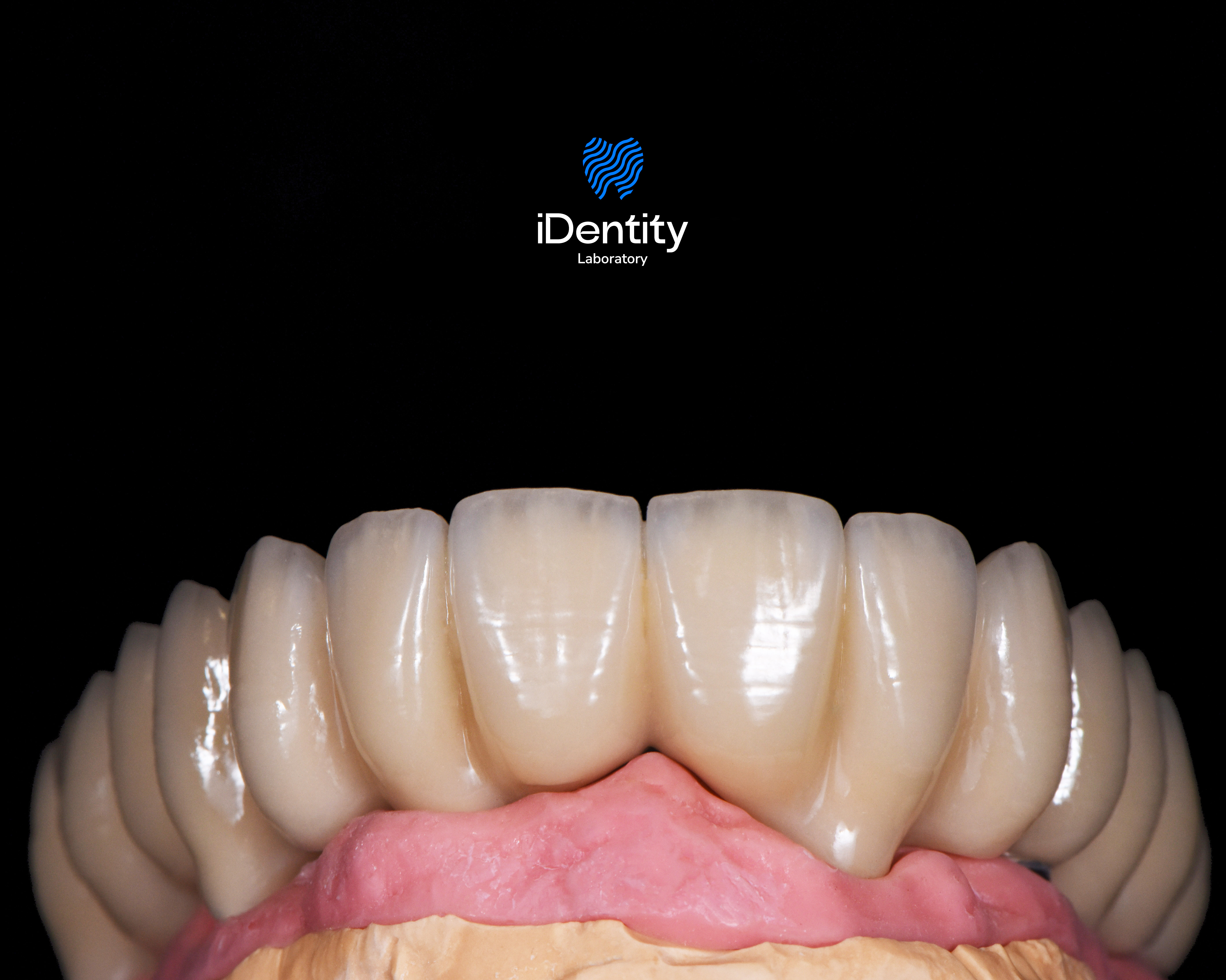 Close-up of a dental model showing upper front teeth and pink gums against a black background with iDentity Laboratory logo above.