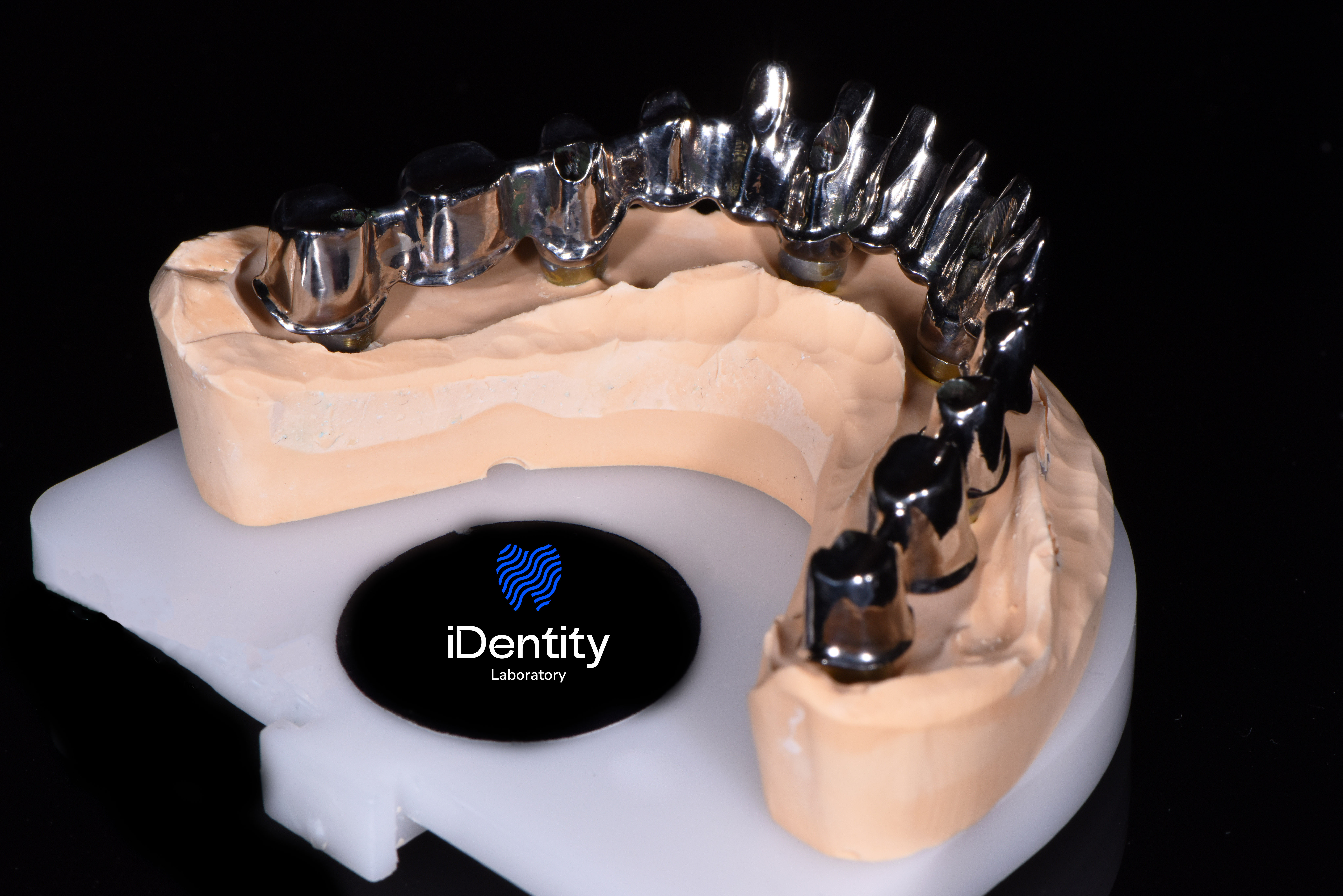 Dental model with metal implant framework on a white base with Identity Laboratory logo.