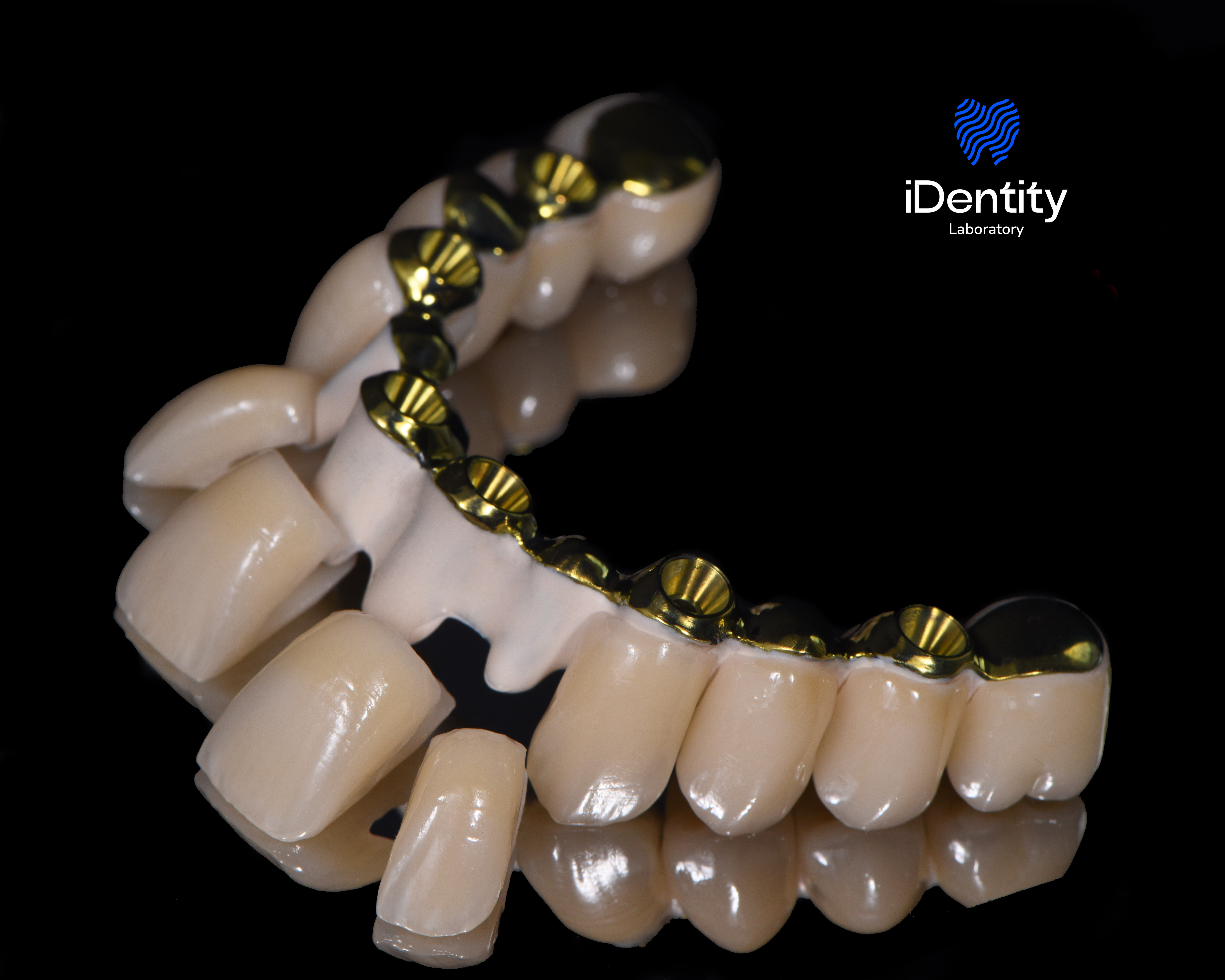 Dental prosthetic with ceramic teeth and gold inner framework on reflective black surface.