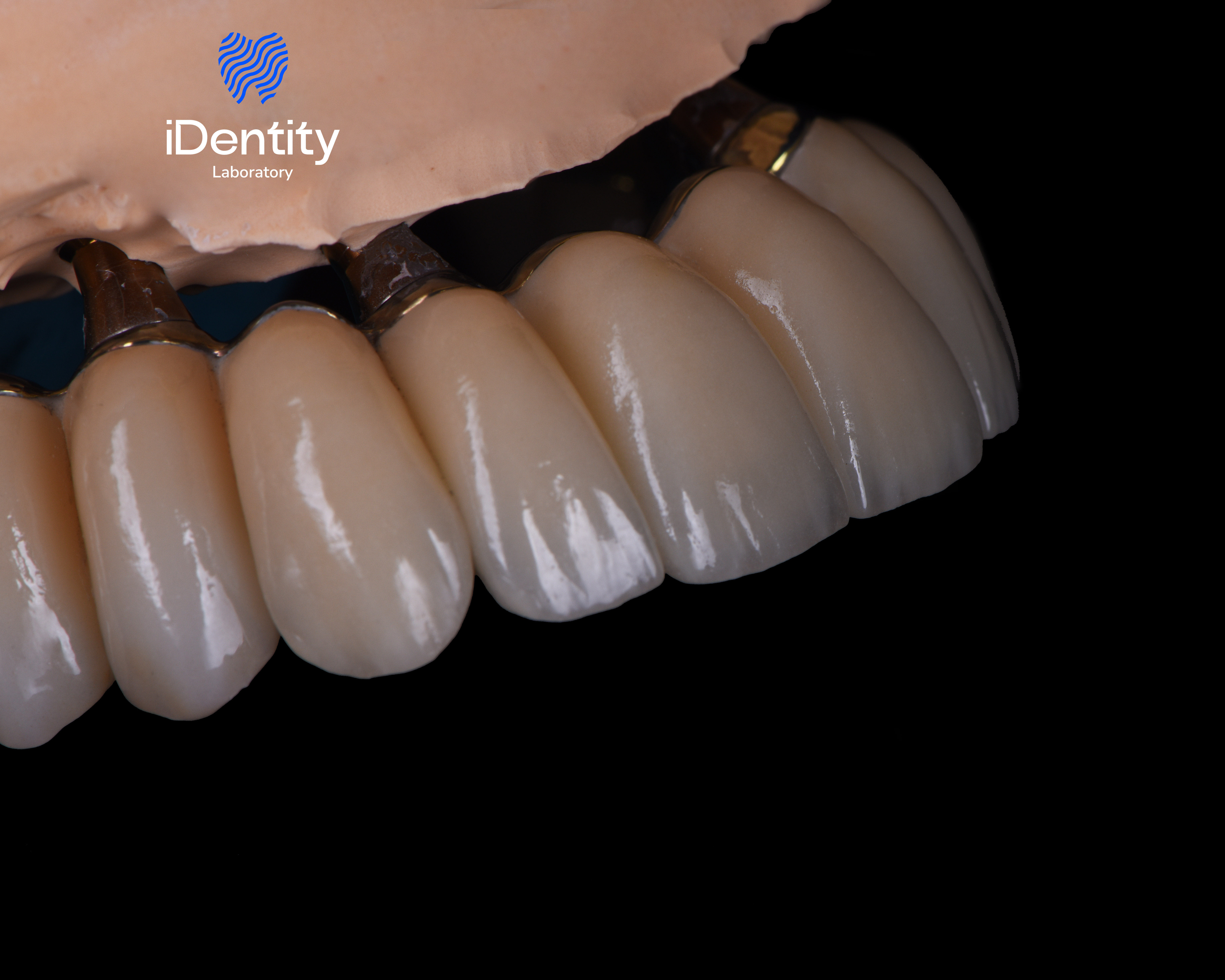 Close-up of dental prosthetic teeth attached to a gum-colored base against a black background.