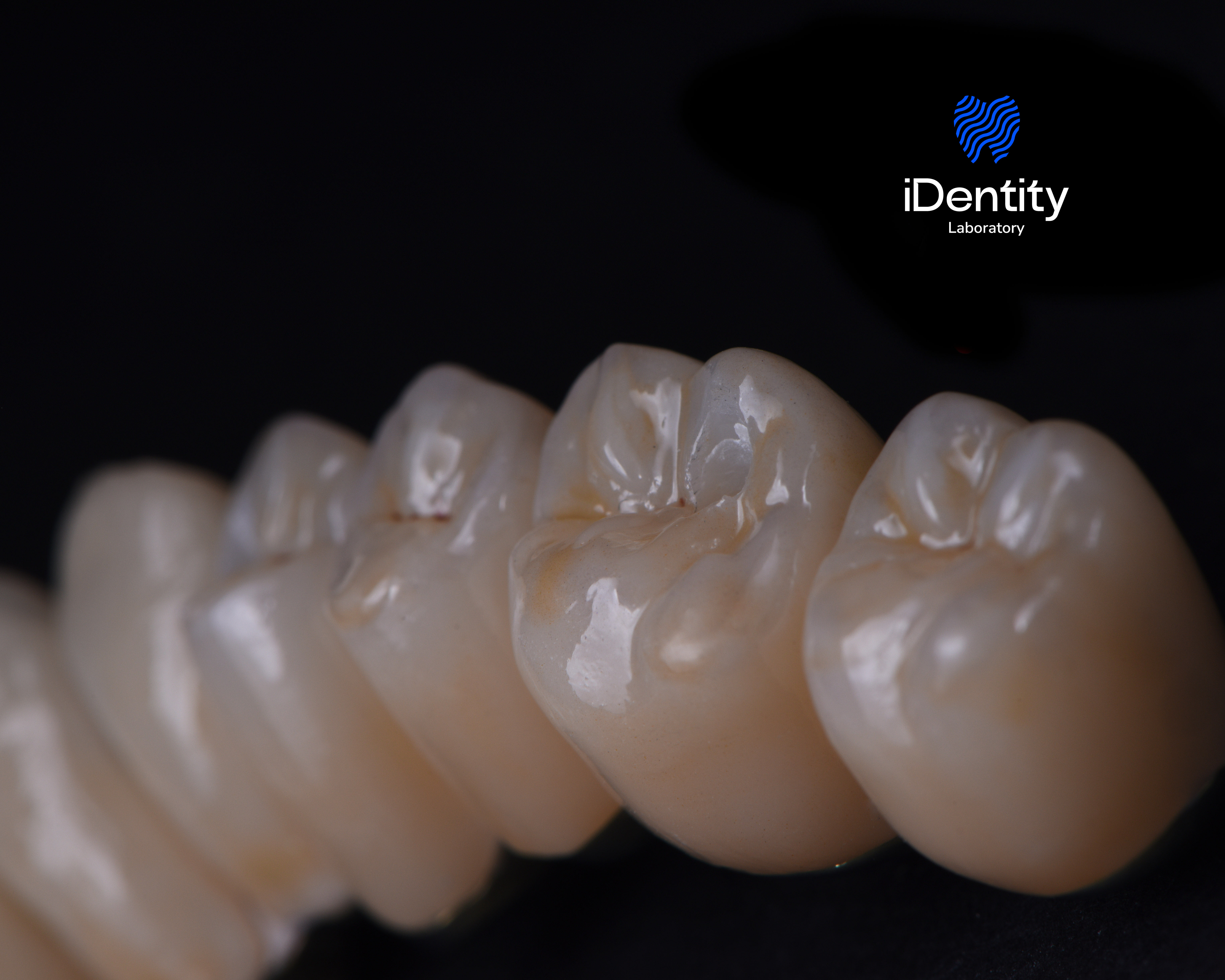Close-up of dental crowns or teeth models on a dark background with an 'iDentity Laboratory' logo.