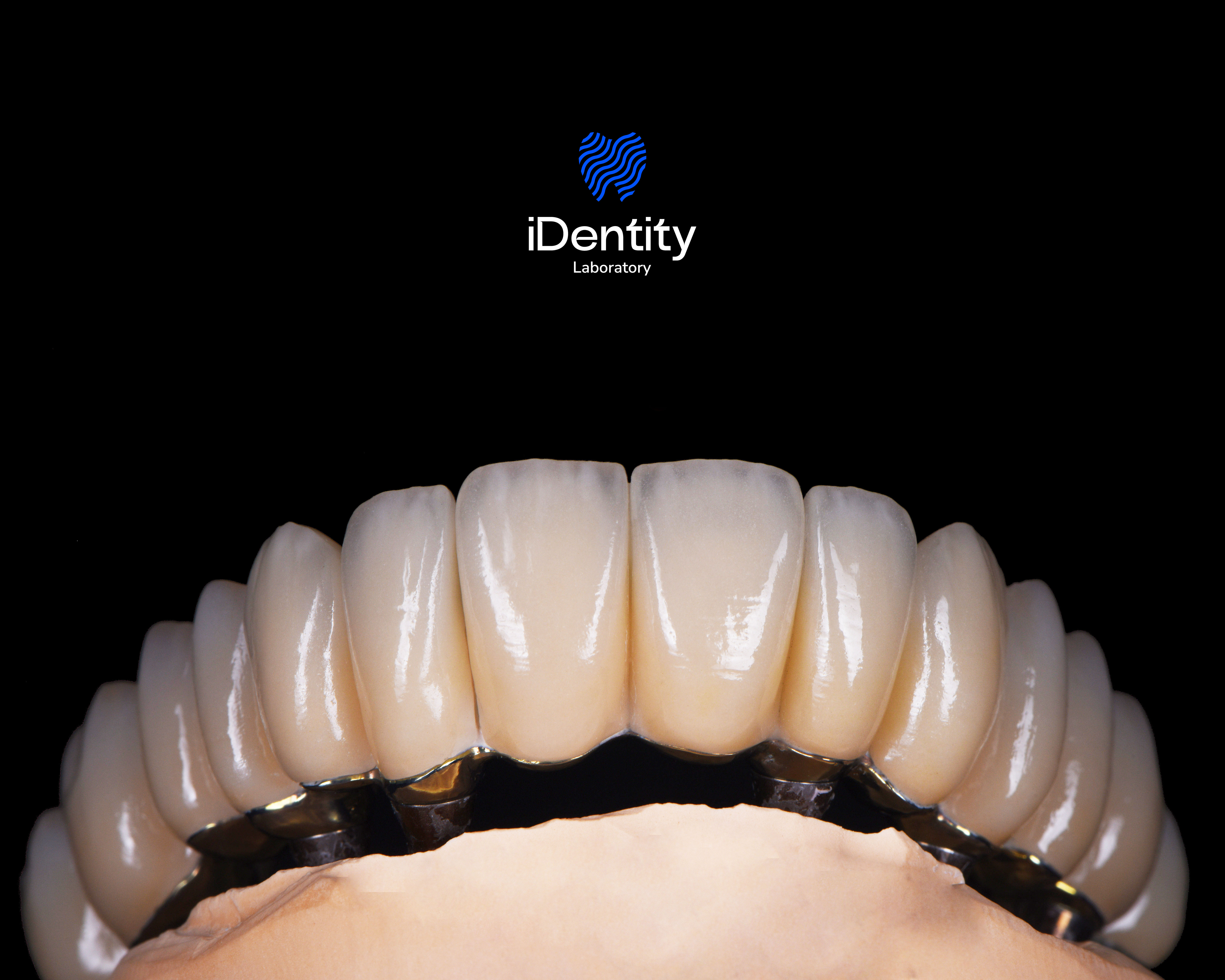 Close-up of dental prosthetic teeth mounted on a model, with a black background and Identity Laboratory logo above.